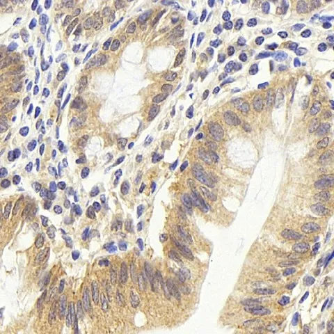 CDC25A Polyclonal Antibody - image 1