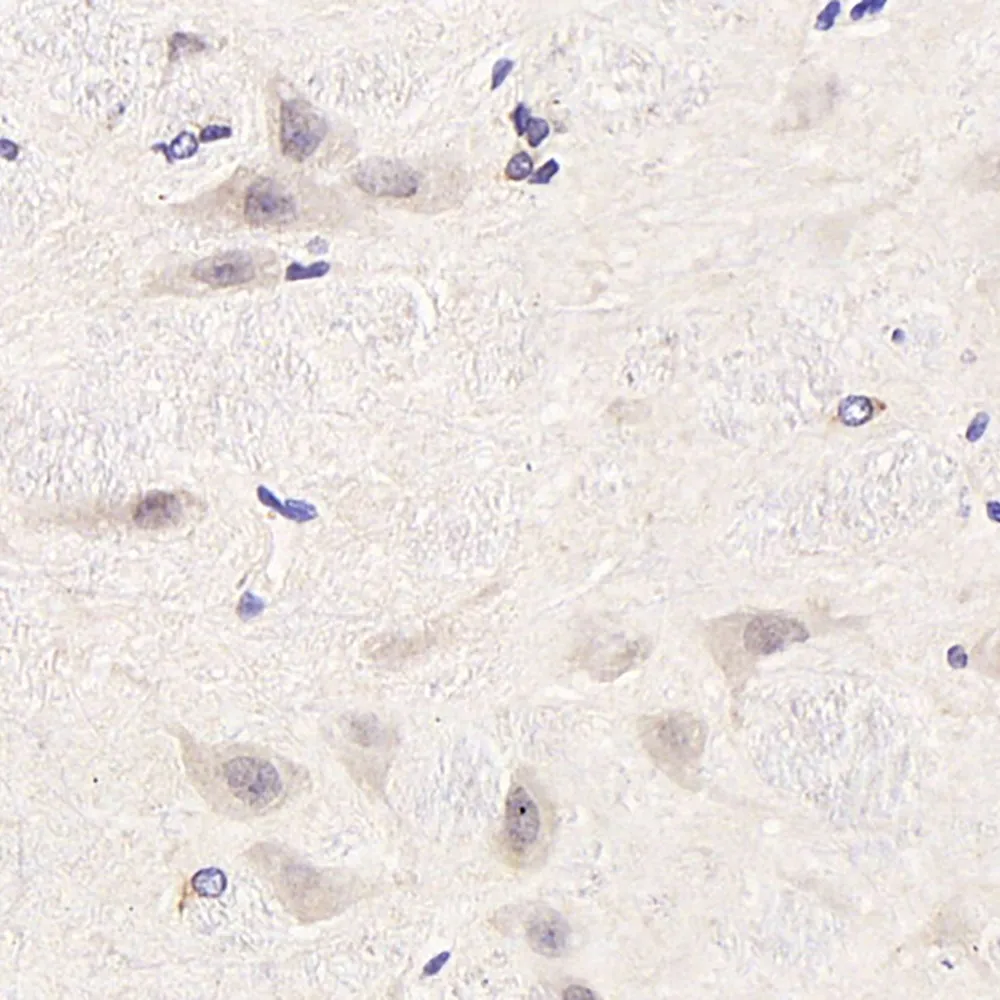 CDC25A Polyclonal Antibody - image 3