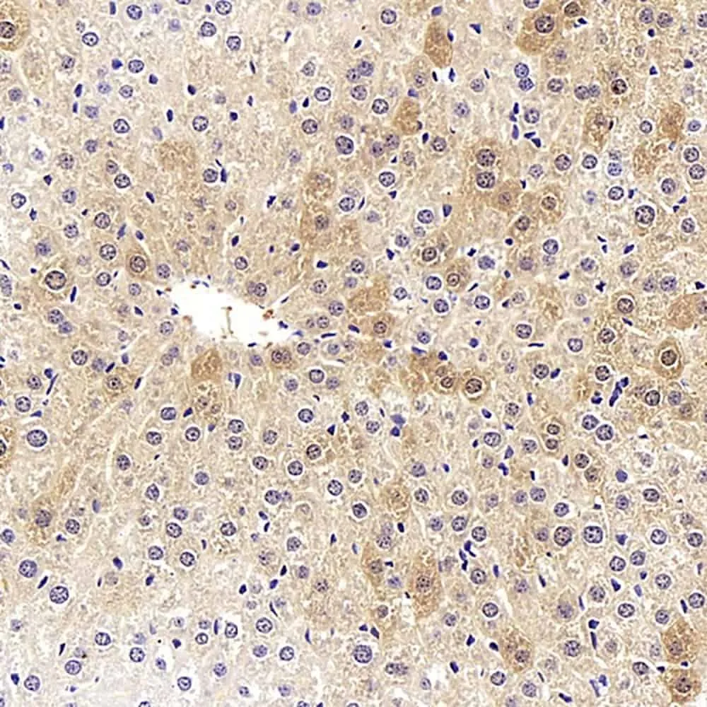 COL18A1 Polyclonal Antibody - image 1