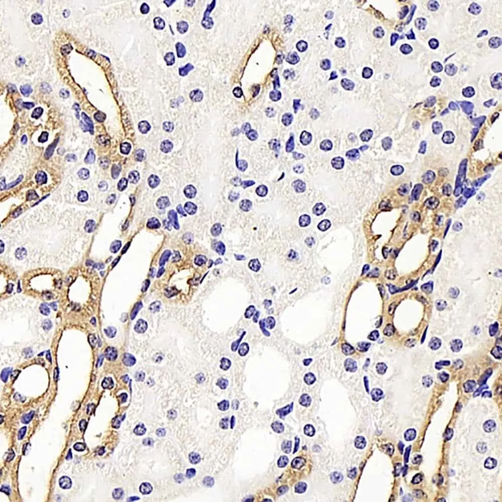 COL18A1 Polyclonal Antibody - image 2