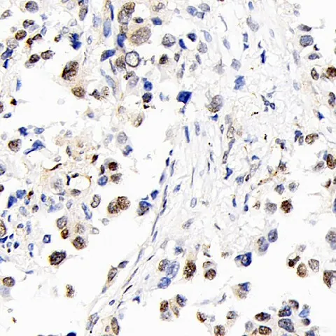 S100A4 Polyclonal Antibody - image 1