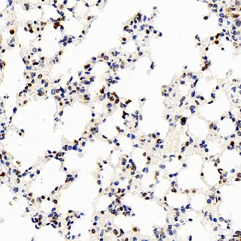S100A4 Polyclonal Antibody - image 2