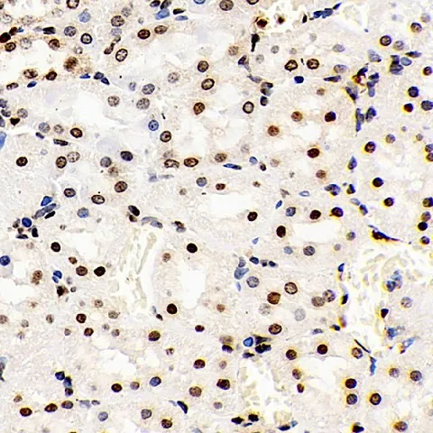 S100A4 Polyclonal Antibody - image 3