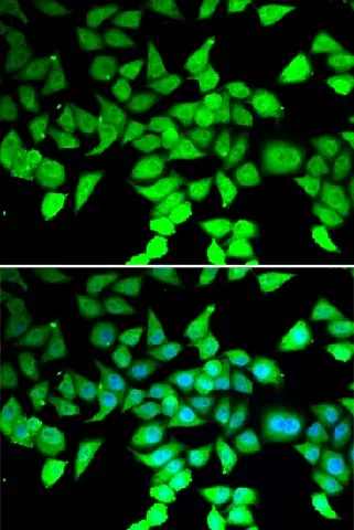 HDAC7 Polyclonal Antibody - image 1