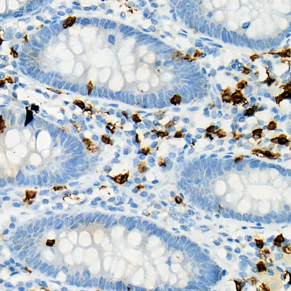 CD8A Polyclonal Antibody - image 1
