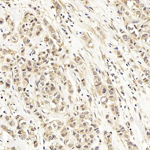 ATF2 Polyclonal Antibody - image 1