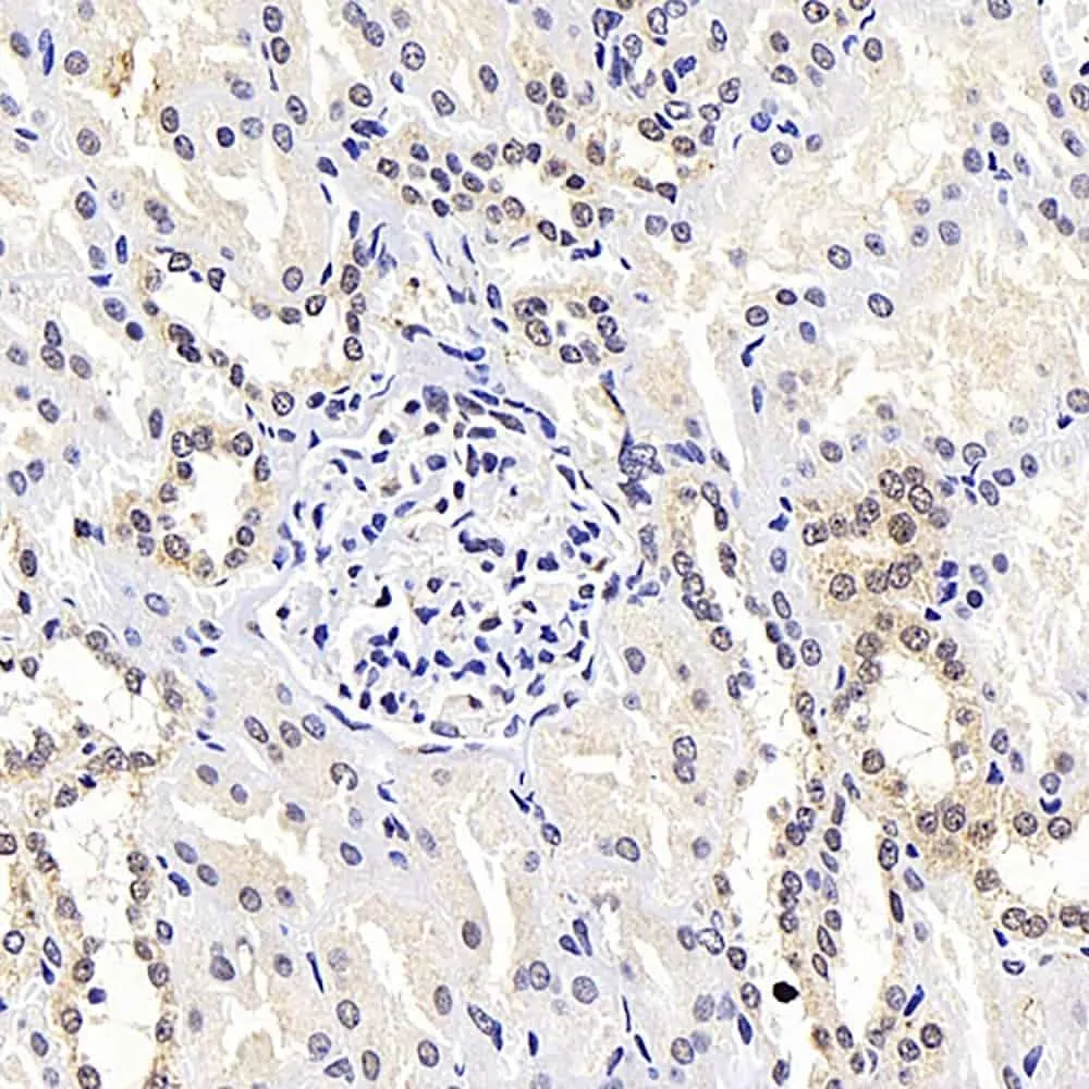 ATF2 Polyclonal Antibody - image 2