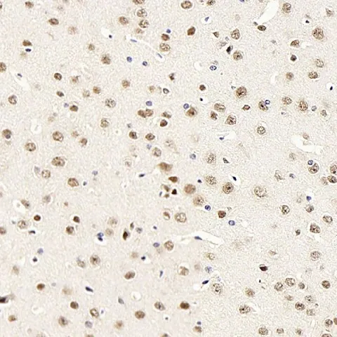 ATF2 Polyclonal Antibody - image 3