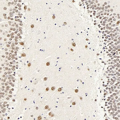 ATF2 Polyclonal Antibody - image 4
