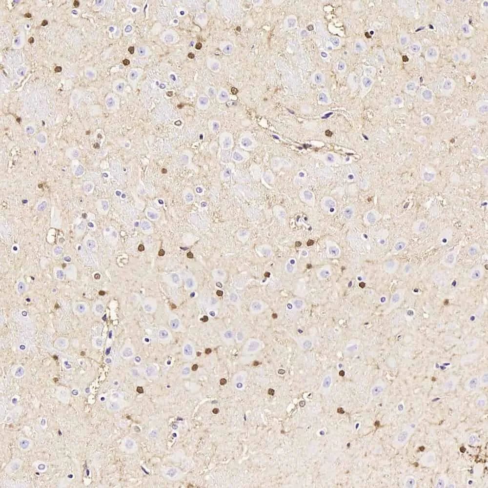 S100B Polyclonal Antibody - image 1