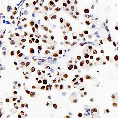 PCNA Polyclonal Antibody - image 1