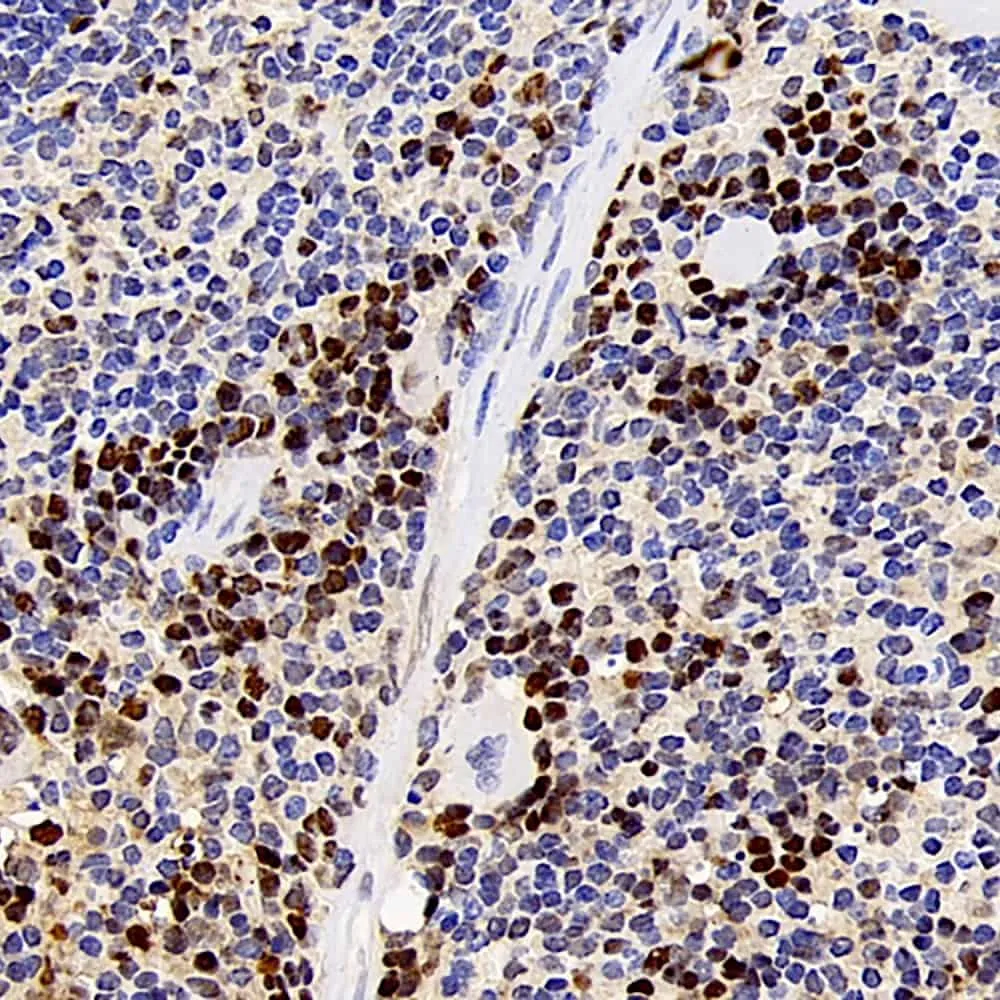 PCNA Polyclonal Antibody - image 2