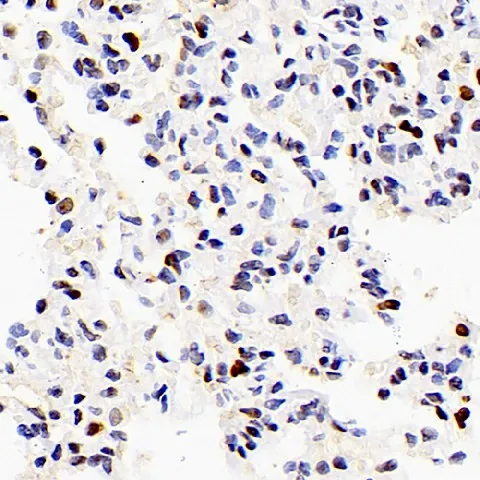 PCNA Polyclonal Antibody - image 3