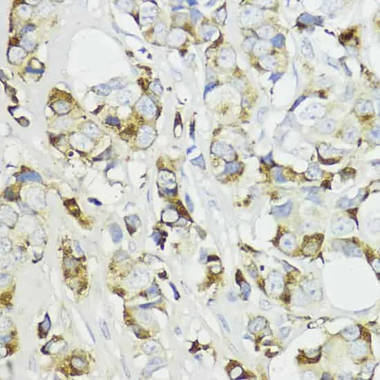 Complement Factor B Polyclonal Antibody - image 1