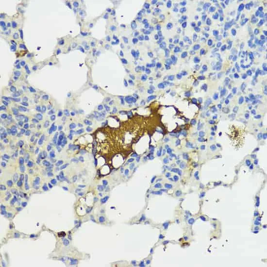 Complement Factor B Polyclonal Antibody - image 3
