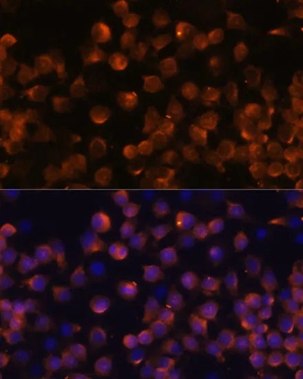 Complement Factor B Polyclonal Antibody - image 4