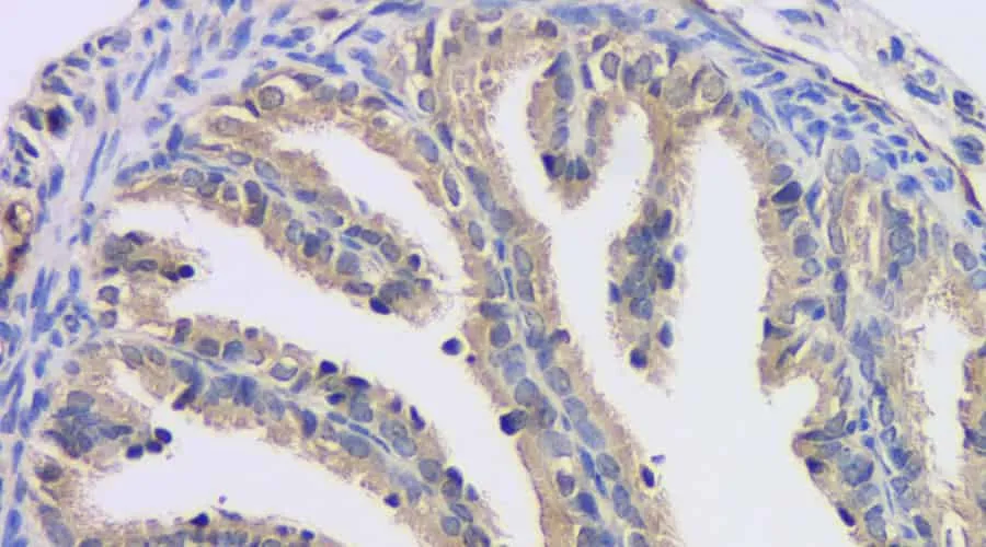 FSHR Polyclonal Antibody - image 1