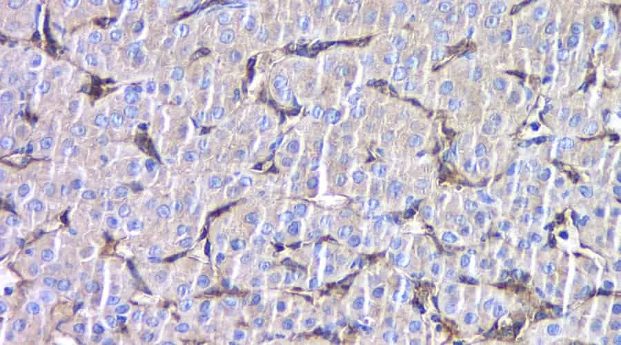 FSHR Polyclonal Antibody - image 2