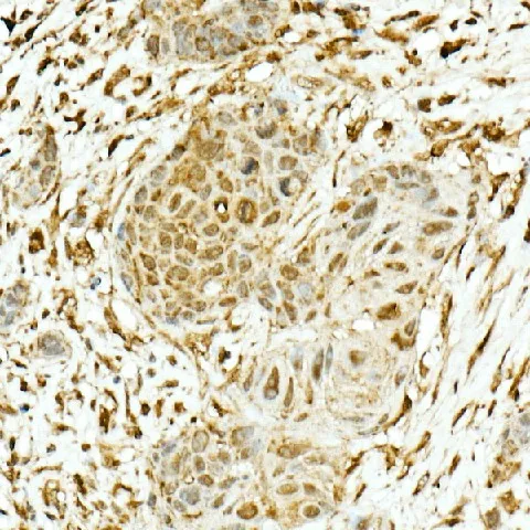 NRF2 Polyclonal Antibody - image 2
