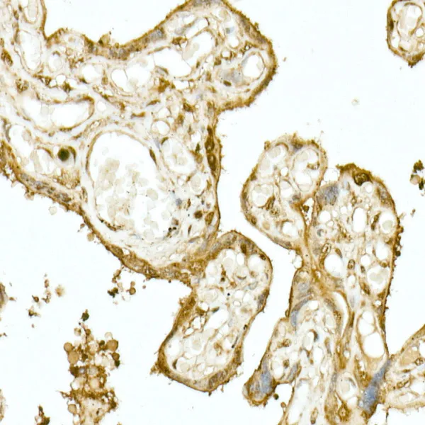 NRF2 Polyclonal Antibody - image 3