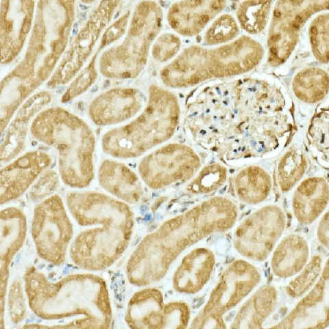NRF2 Polyclonal Antibody - image 4