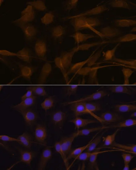 TIMP2 Polyclonal Antibody - image 1