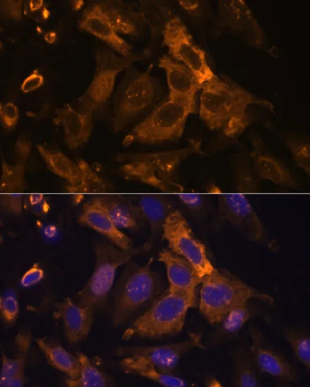 TIMP2 Polyclonal Antibody - image 2