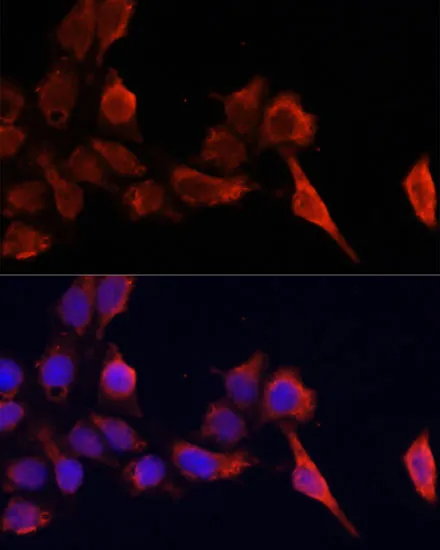 TIMP1 Polyclonal Antibody - image 1