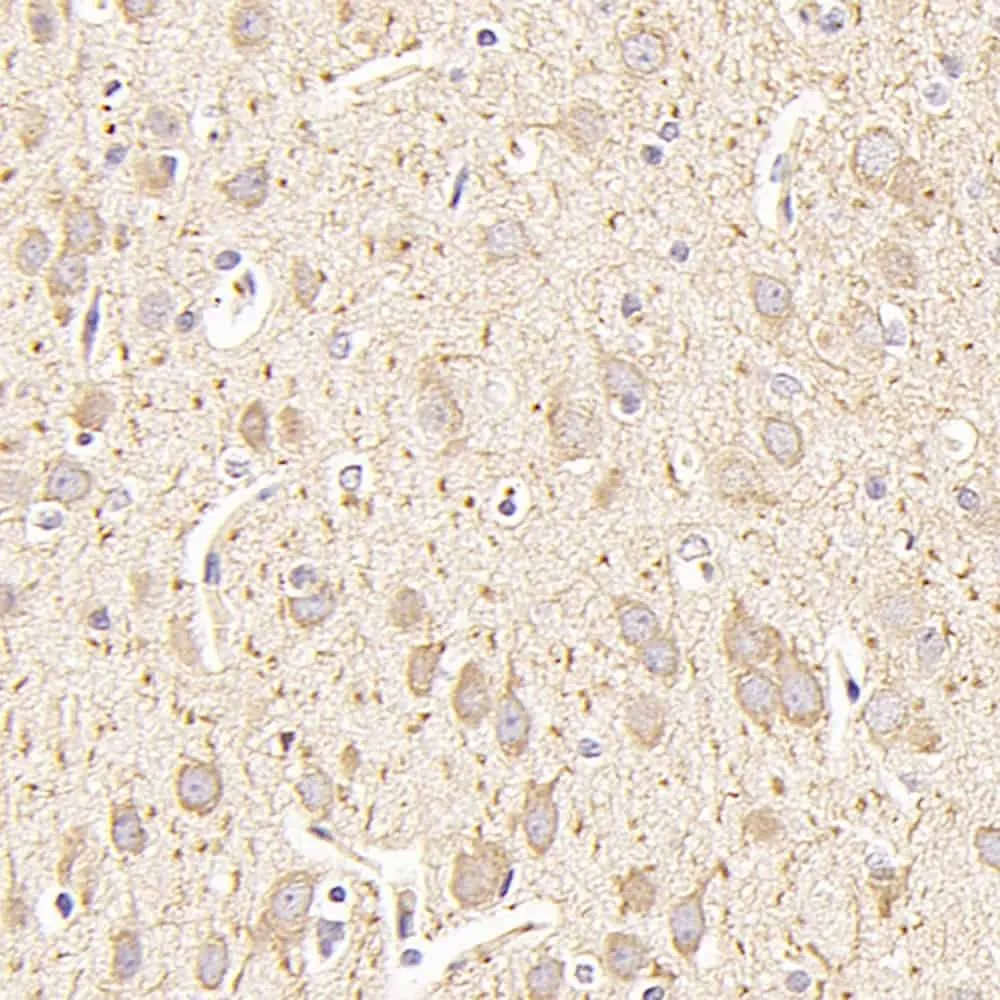 MAP2 Polyclonal Antibody - image 1