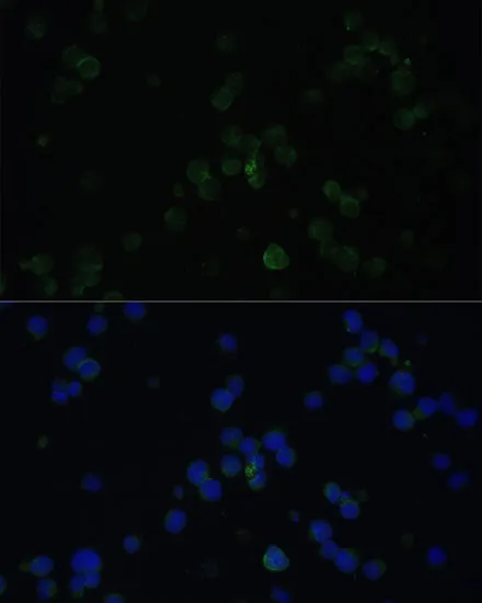 CD3D Polyclonal Antibody - image 1