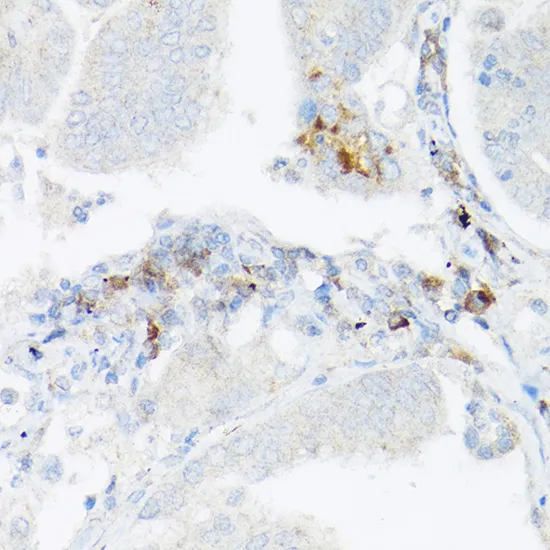 TNF-α Polyclonal Antibody - image 1