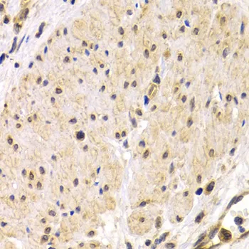 TMPRSS2 Polyclonal Antibody - image 1