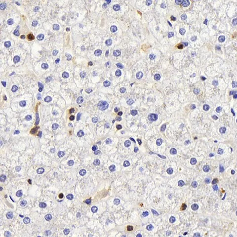 C-Kit Polyclonal Antibody - image 1