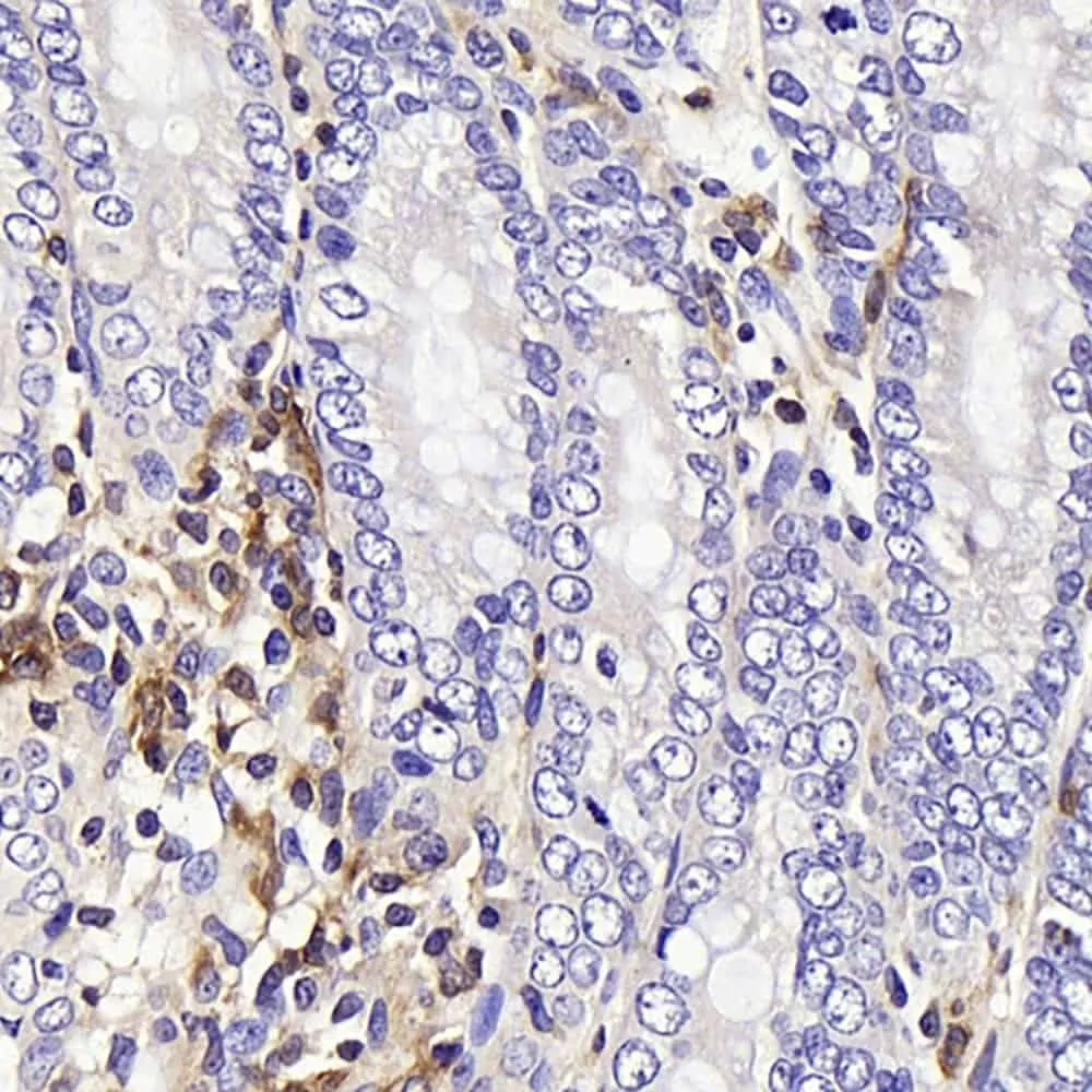 C-Kit Polyclonal Antibody - image 2