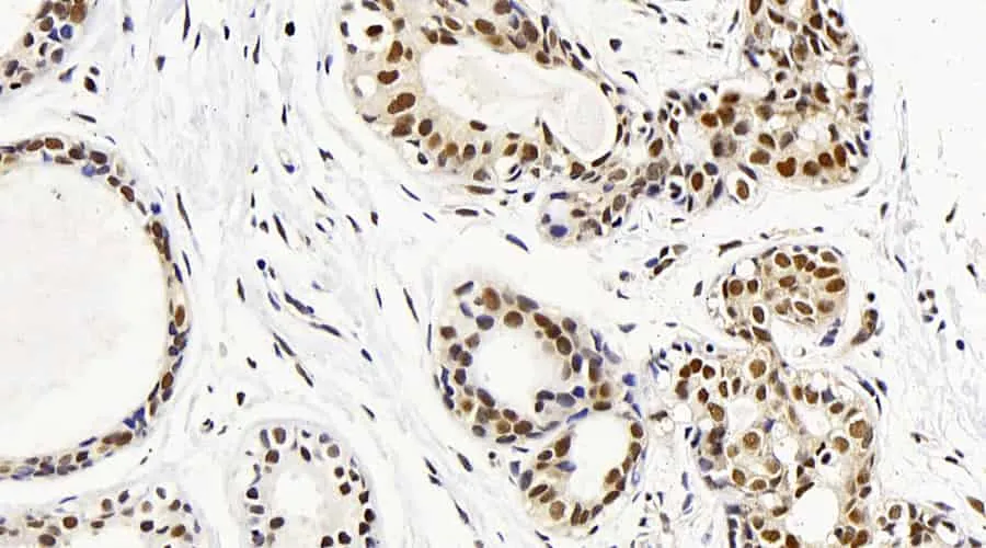 MAP2K1 Polyclonal Antibody - image 1