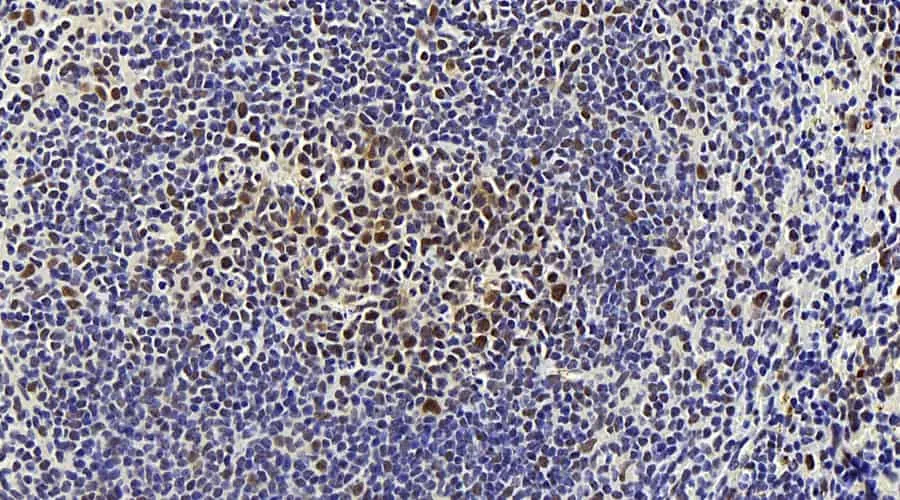 MAP2K1 Polyclonal Antibody - image 2