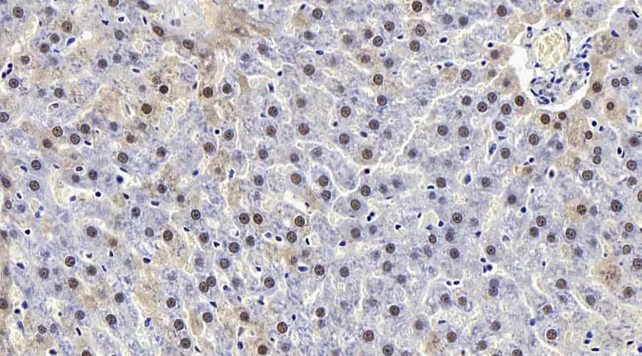 MAP2K1 Polyclonal Antibody - image 3