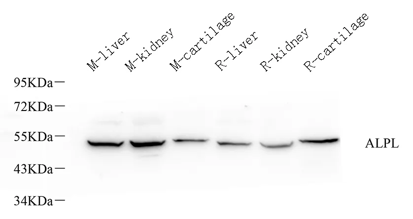 ALPL Polyclonal Antibody - image 1
