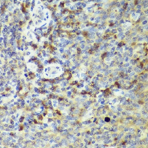 IL18 Polyclonal Antibody - image 4