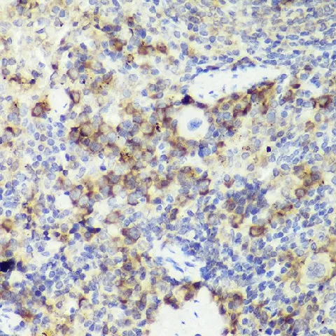 IL18 Polyclonal Antibody - image 5