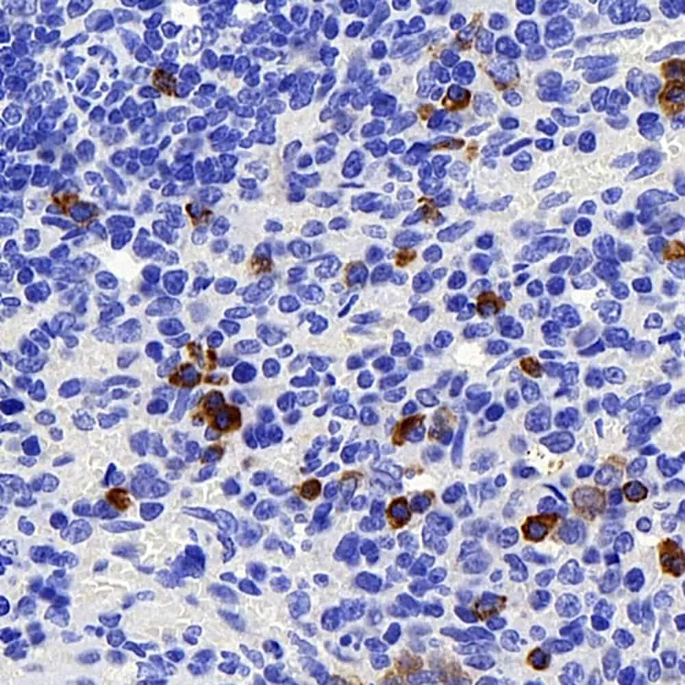 BAG2 Polyclonal Antibody - image 1