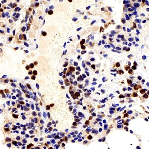 Galectin 3 Polyclonal Antibody - image 1