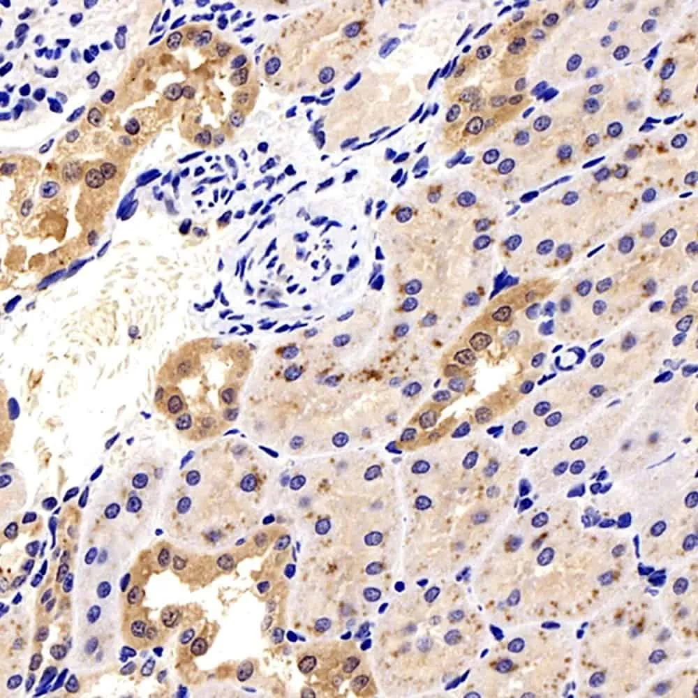 Galectin 3 Polyclonal Antibody - image 2