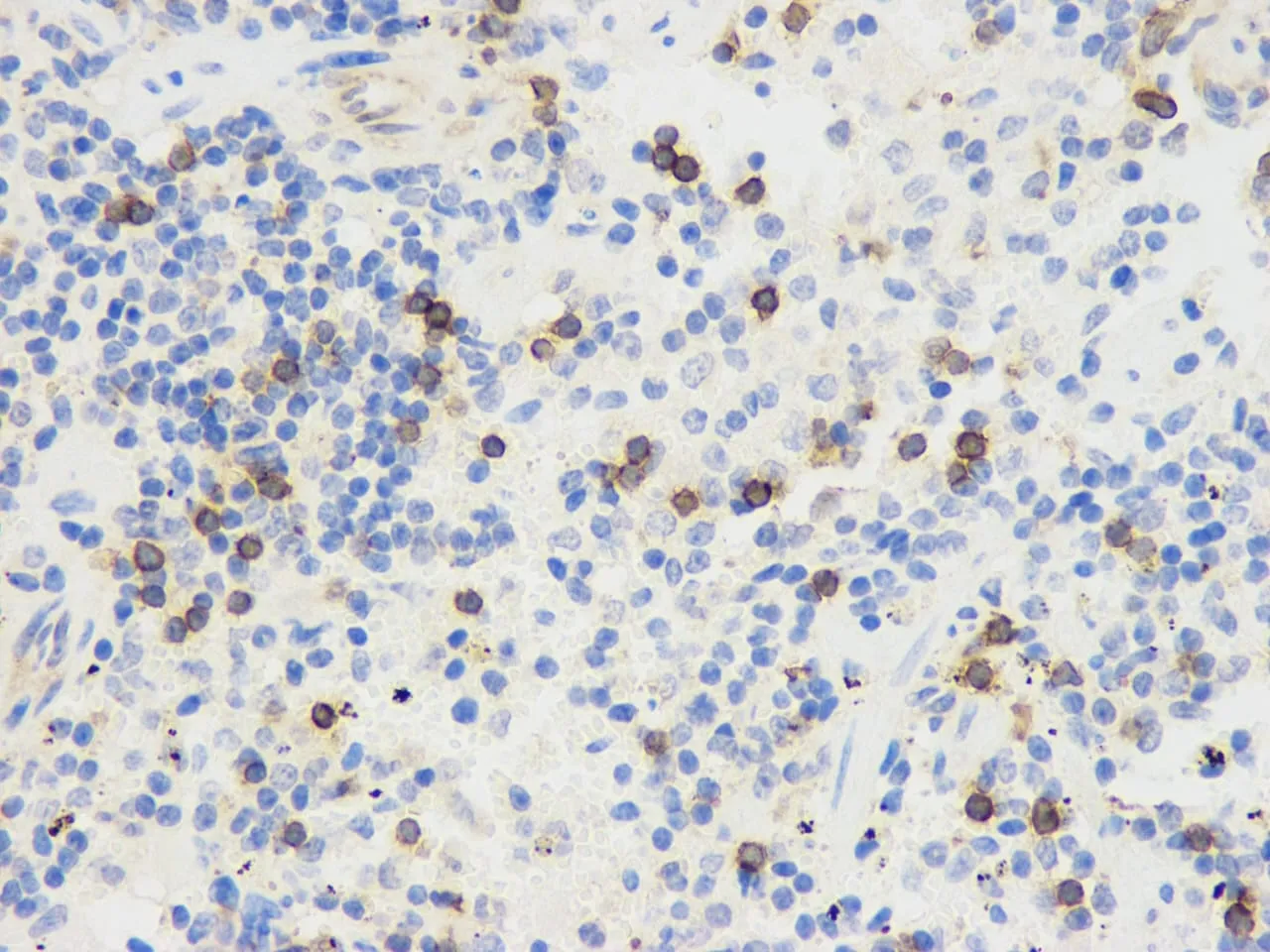 THY1 Polyclonal Antibody - image 1