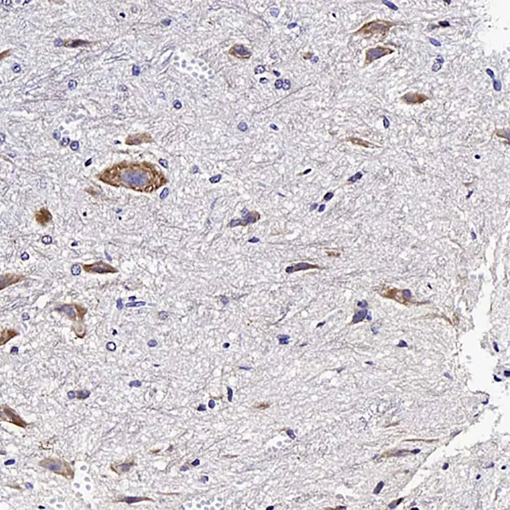 GDNF Polyclonal Antibody - image 1