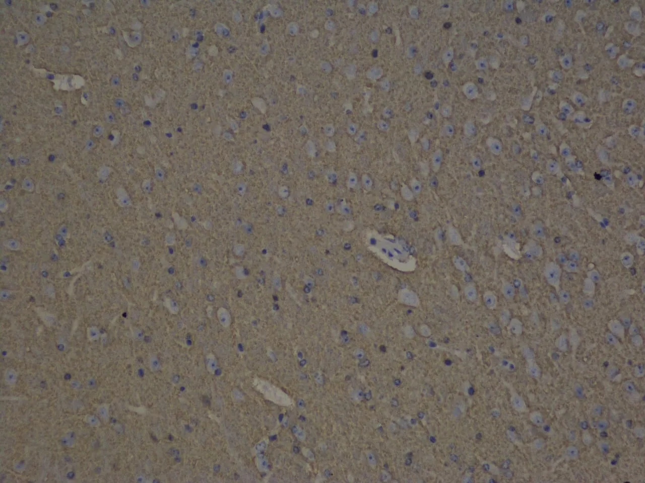 GAP43 Polyclonal Antibody - image 1
