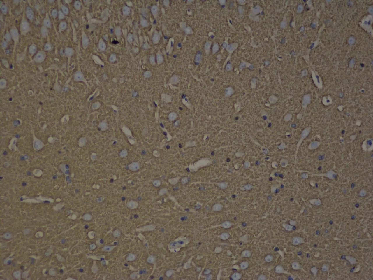 GAP43 Polyclonal Antibody - image 2