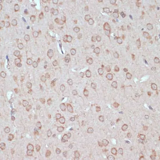 YAP1 Polyclonal Antibody - image 2