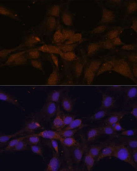 YAP1 Polyclonal Antibody - image 3