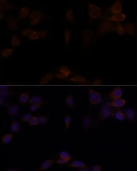 YAP1 Polyclonal Antibody - image 4